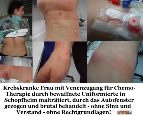 Krebskranke Frau durch bewaffnete Uniformierte in Schopfheim malträtiert